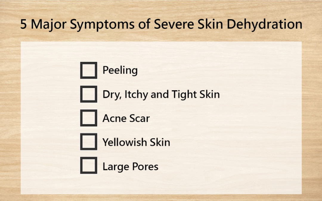 【Secrets to Moisturizing】Be Careful! Five Major Symptoms of Severe Skin Dehydration